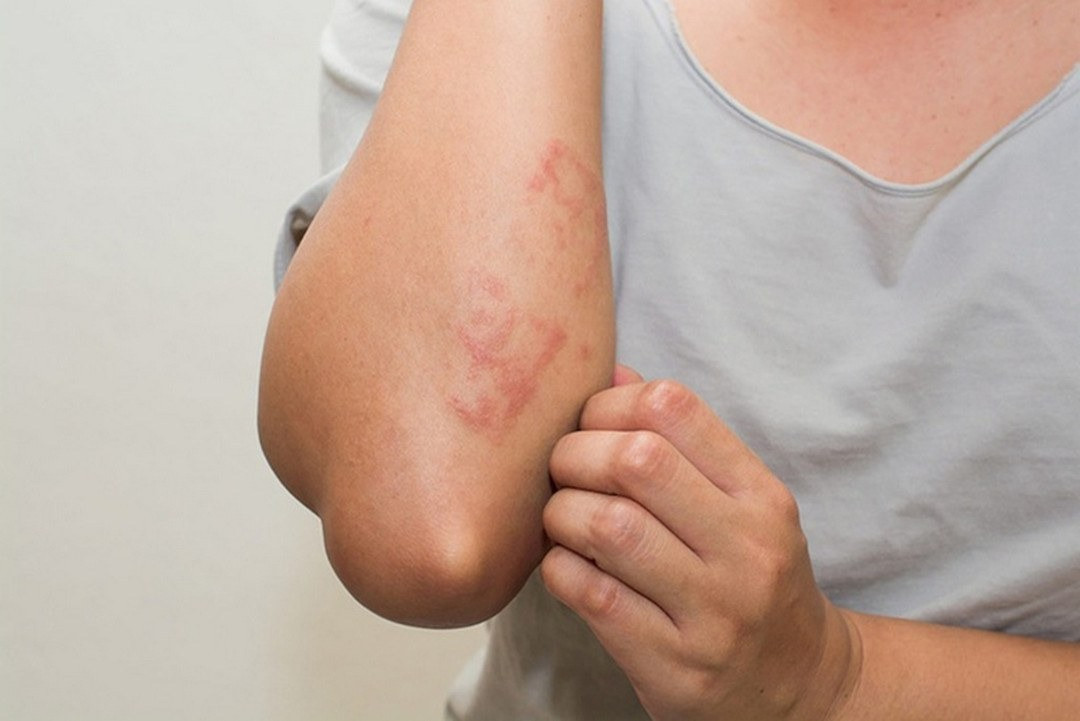  Tủ quần áo bị ẩm mốc có ảnh hưởng tới sức khỏe không?